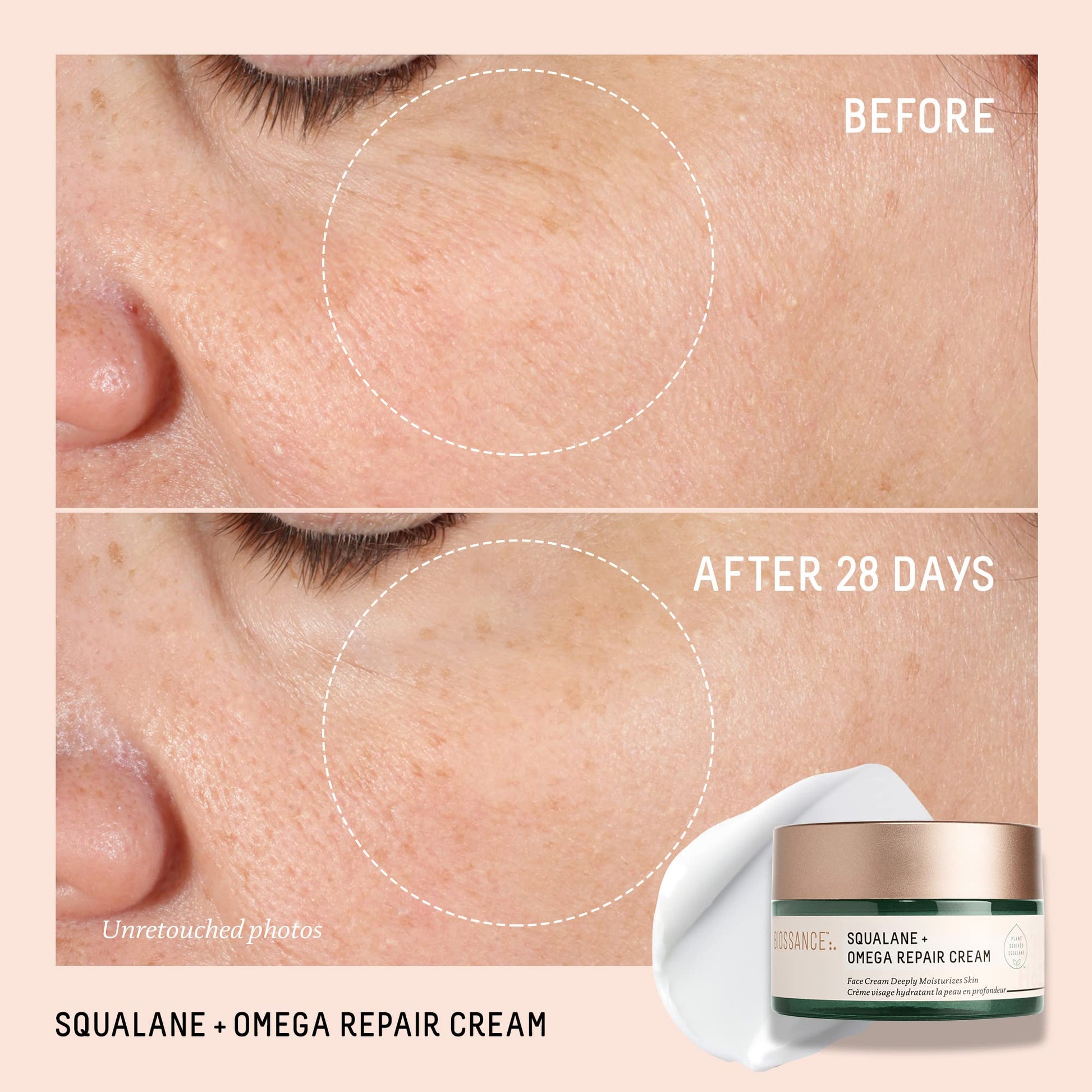 BIOSSANCE Squalane + Omega Repair Cream - Ultra-Moisturizing Face Cream - Skin Care with Hyaluronic Acid, Ceramides, Squalane - Ideal for Dry & Sensitive Skin, Intense Hydration Moisturizer - 1.7oz - Medaid International