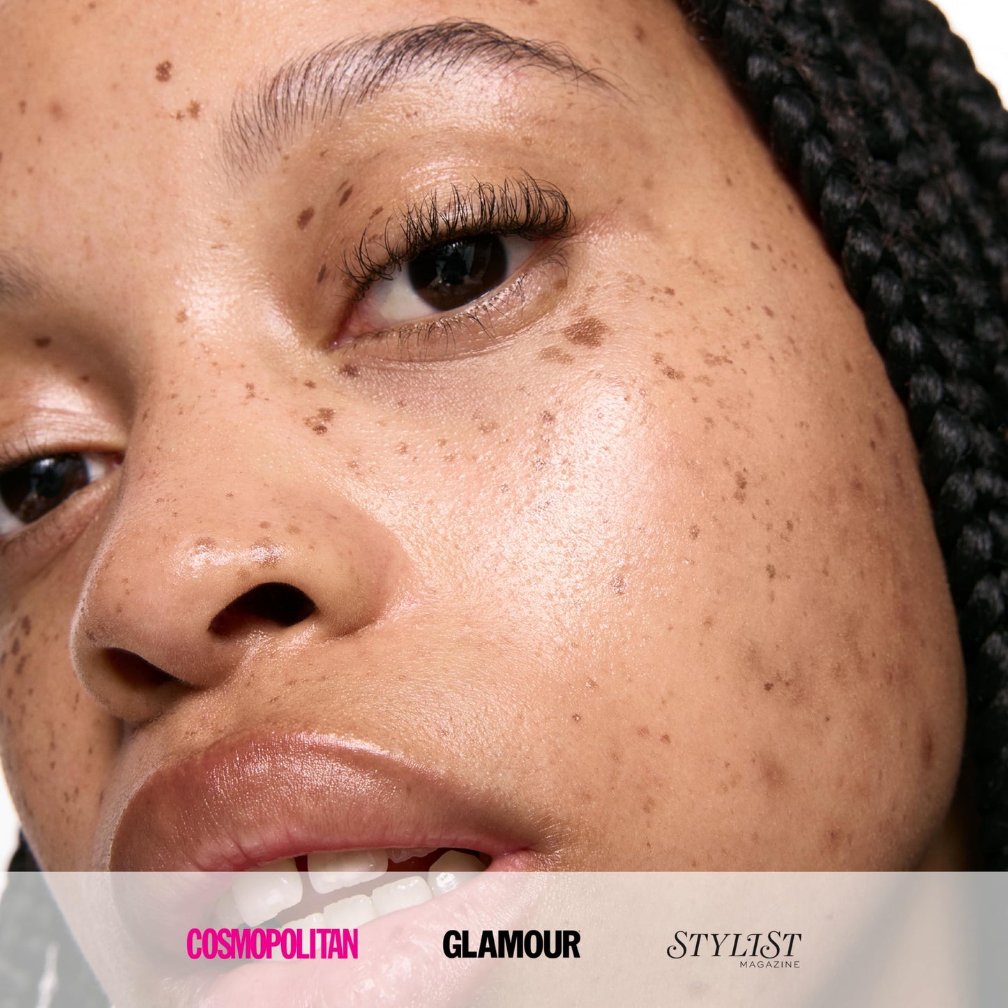 The INKEY List 10% Niacinamide Serum, Lightweight Oil Control Serum Helps with Blemishes and Appearance of Redness, Hydrating 1% Hyaluronic Acid 30ml, 1 fl oz - Medaid International