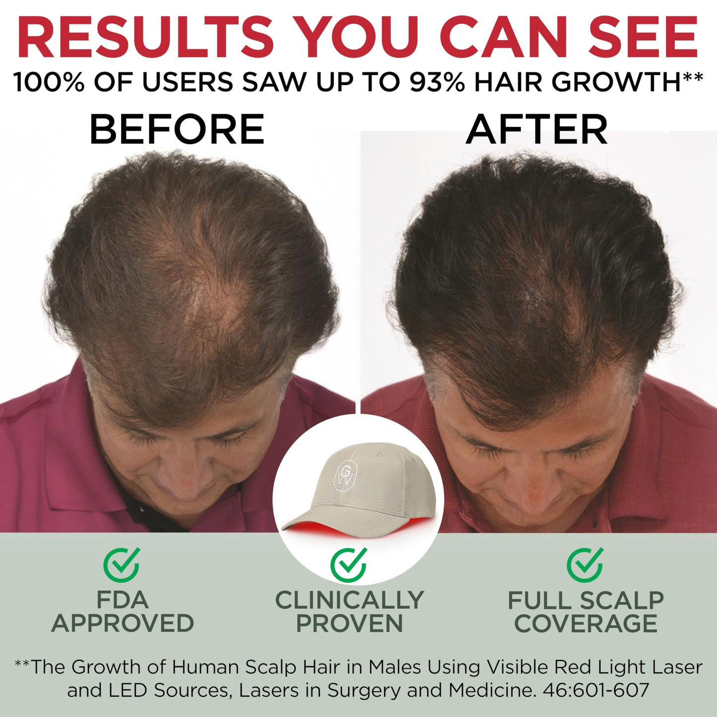 GroWell Red Light Therapy Hair Growth Cap – FDA Cleared Laser Treatment for Hair Regrowth and Reduced Shedding – LED & Laser Red Light Therapy Clinically Proven in Double-Blind Studies -Beige - Medaid International