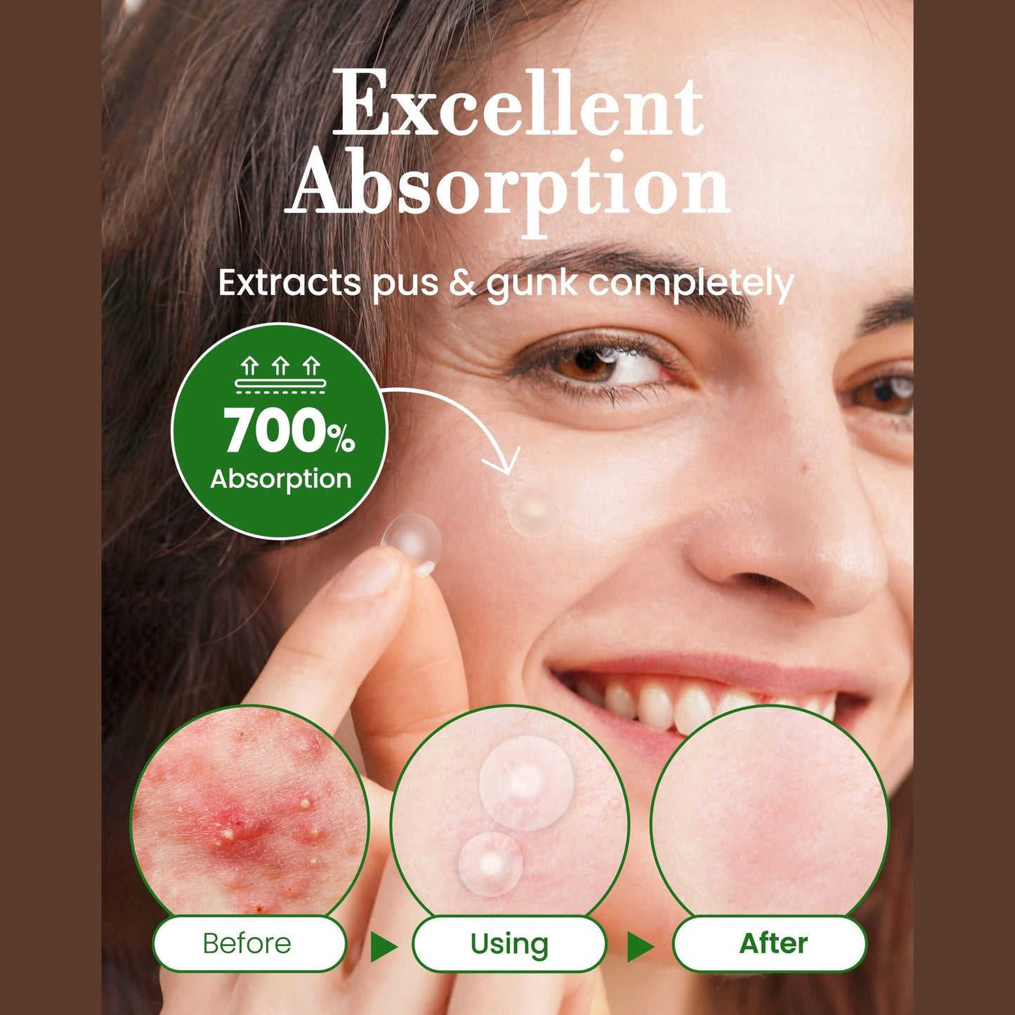 Troubless Invisible Pimple Spot Patch - 96 Ultra Thin Acne Patches - Easy Peel - 2 Sizes - Medaid International