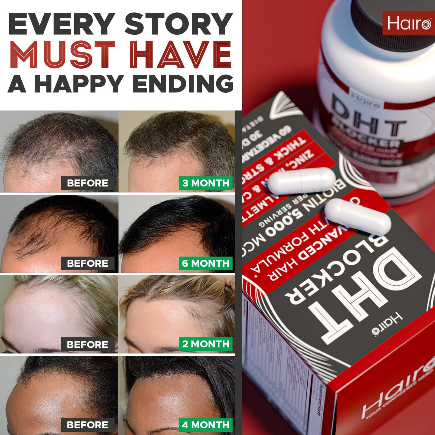 DHT Blocker Hair Growth Supplement - High Potency Biotin & Saw Palmetto for Hair Regrowth - Natural Hair Loss Treatments for Women & Men - Helps Stimulate Hair Follicle Growth - Medaid International