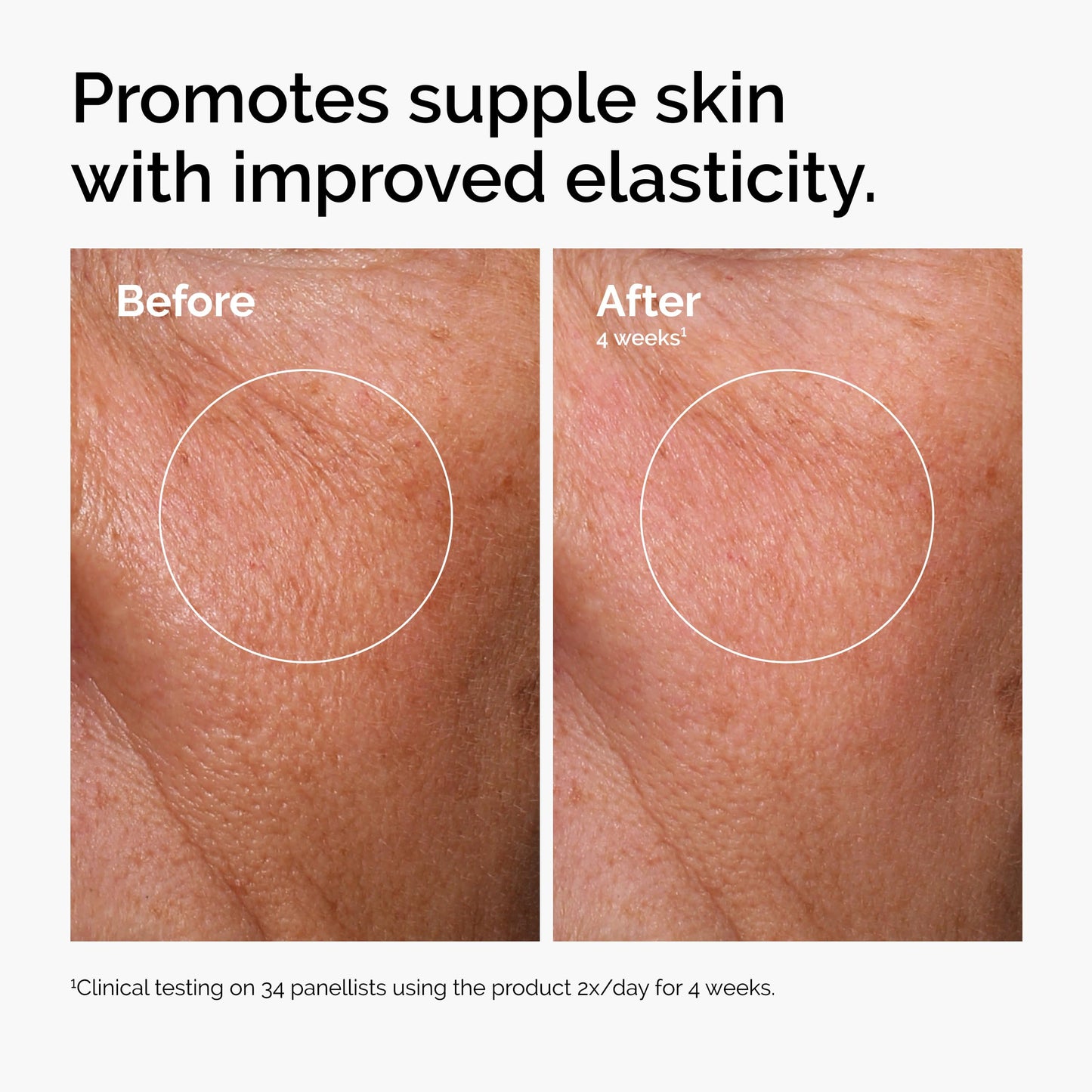 The Ordinary Hyaluronic Acid 2% + B5 (with Ceramides), Multi-Depth Hydration Serum for Plumper, Smoother Skin, 1 Fl Oz - Medaid International