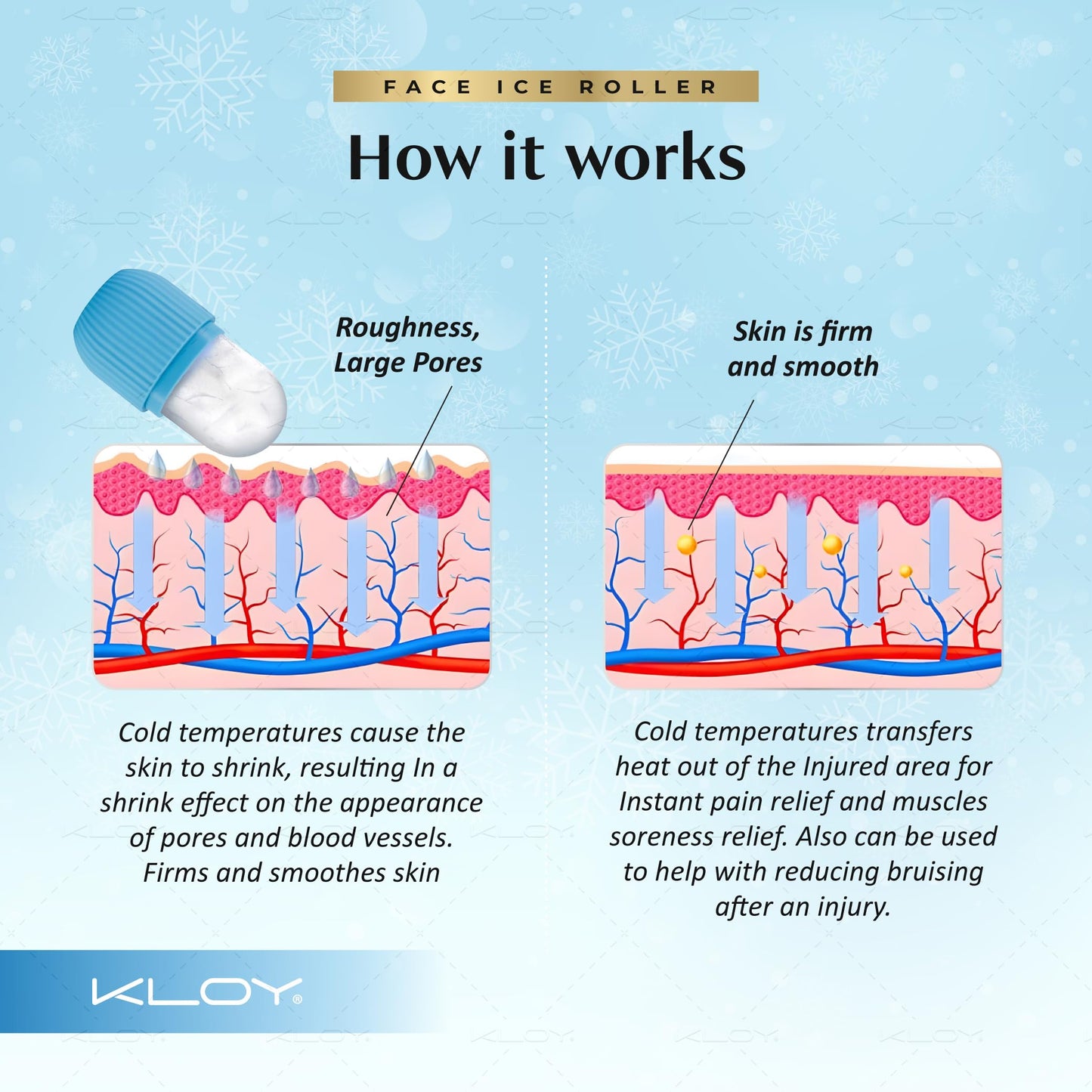 KLOY Ice Roller For Face, Neck And Body | For Puffy Eyes And Facial Skin Care, Ice Facial Cube (Random Color) - Medaid International