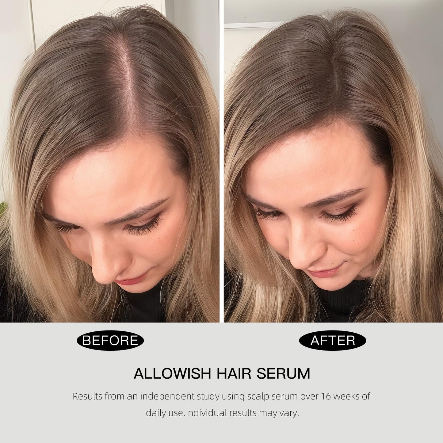 ALLOWISH Hair Growth Serum 95 ml - Rosemary Hair Thickening Serum with Biotin, Caffeine for Hair Thinning & Shedding – Promotes Healthy Scalp, Fuller, Nourish, Strengthens Roots - Medaid International