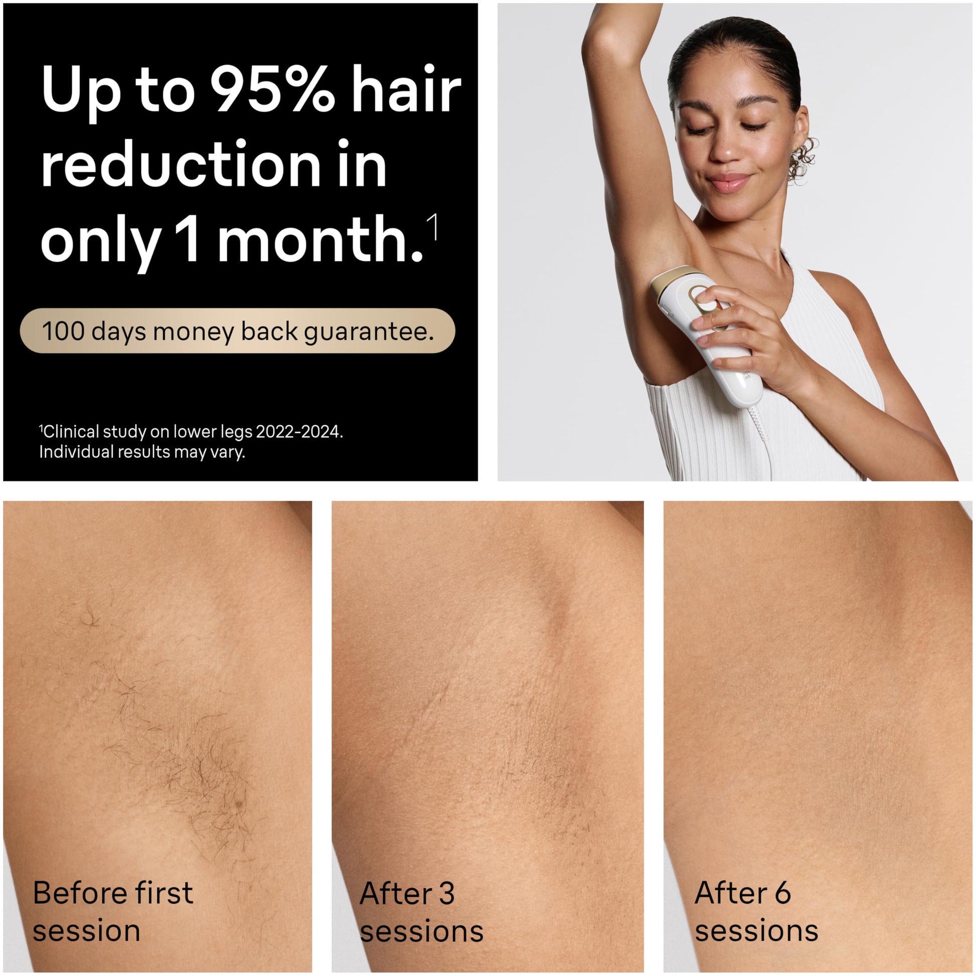 Braun IPL Silk·Expert Pro 5 PL5157 Latest Generation IPL, Permanent Visible Hair Reduction, Holiday Gifts for Women and Men, at-Home Hair Removal System with Soft Pouch and Precision Head - Medaid International