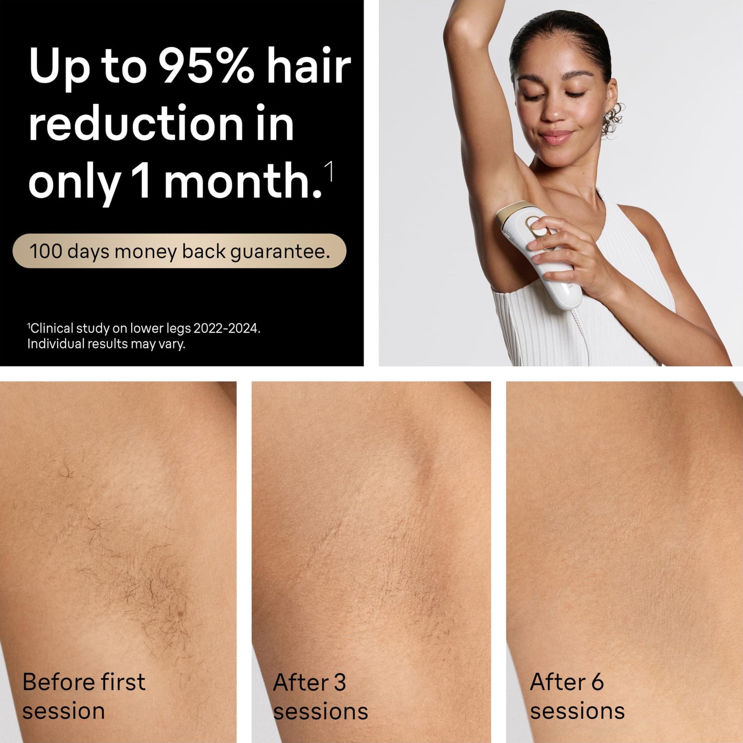Braun Smart IPL, Silk·Expert Pro 5: at Home Laser Hair Removal for Women and Men, Permanent Visible Hair Reduction in Hair Regrowth for Body & Face, Wide Head and Two Precision Heads, IPL5347 - Medaid International