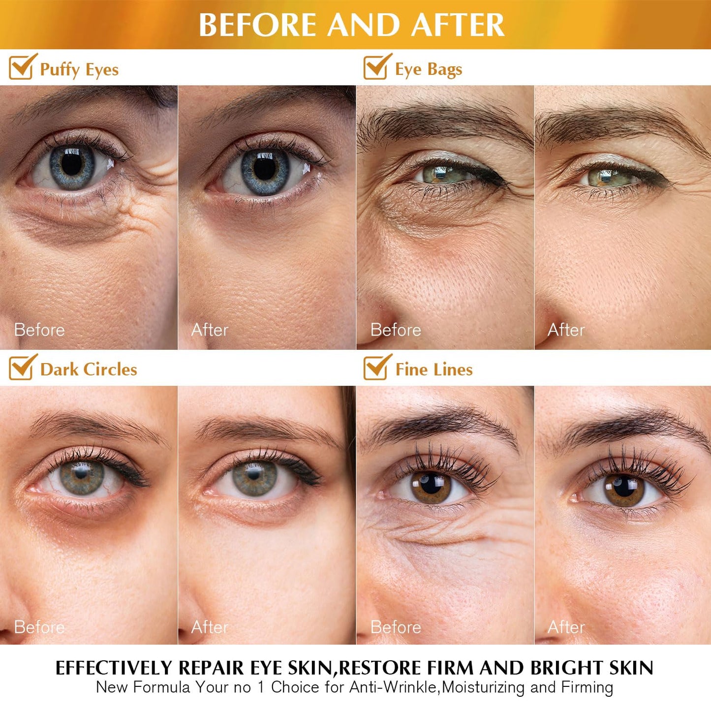 Enaskin Naturals Under Eye Patches Dark Circles Under Eye Masks for Puffiness - 24K Gold Eye Gel Pads Retinol Collagen Hyaluronic Acid Moisturizing & Reducing Wrinkles (24K Gold) - Medaid International