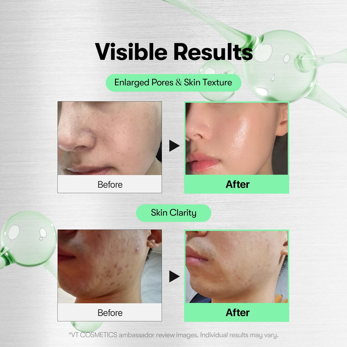 VT COSMETICS CICA Reedle Shot 700, Spicule Microneedling Serum for Pore Care&Exfoliation, Exosome&Centella Asiatica for Glass Skin, Acne&Blemish Care, Korean Liquid Skin Booster (1 Fl Oz / 30ml) - Medaid International