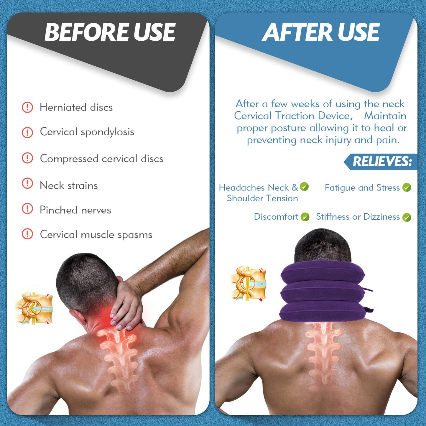 Jaximy Neck Stretcher for Neck Pain Relief, Cervical Traction Device, Neck Traction Device, Adjustable Inflatable Neck Brace & Cervical Neck Traction Device Home Use Decompression(Purple) - Medaid International