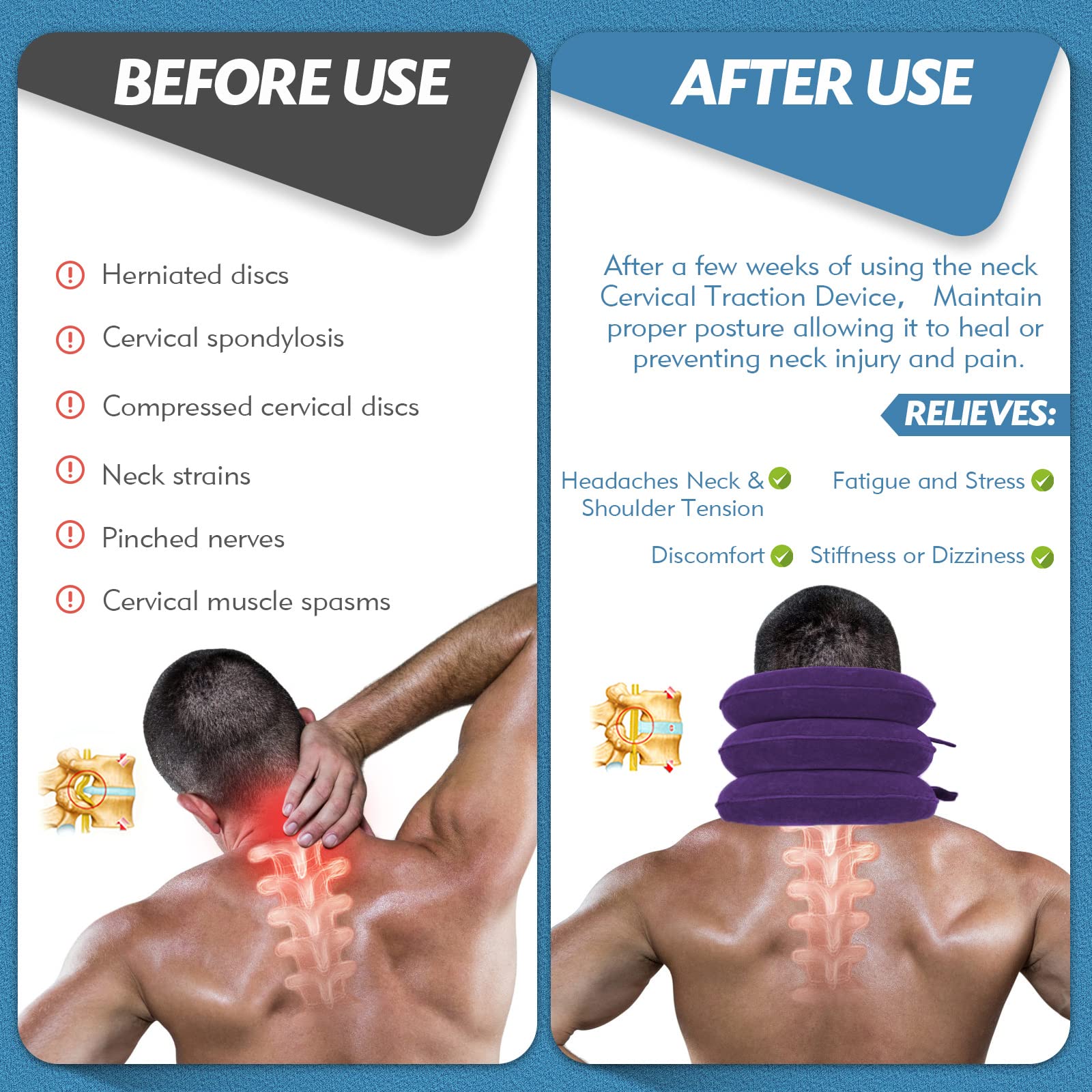 Jaximy Neck Stretcher for Neck Pain Relief, Cervical Traction Device, Neck Traction Device, Adjustable Inflatable Neck Brace & Cervical Neck Traction Device Home Use Decompression(Purple) - Medaid International
