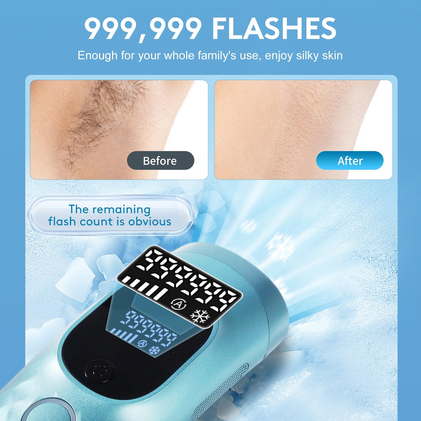 Laser Hair Removal for Women and Men - Permanent Painless Ice Cooling IPL Device Remover Machine with Shaver, Goggles, 999,999 Flashes for Body and Face, Corded - Medaid International