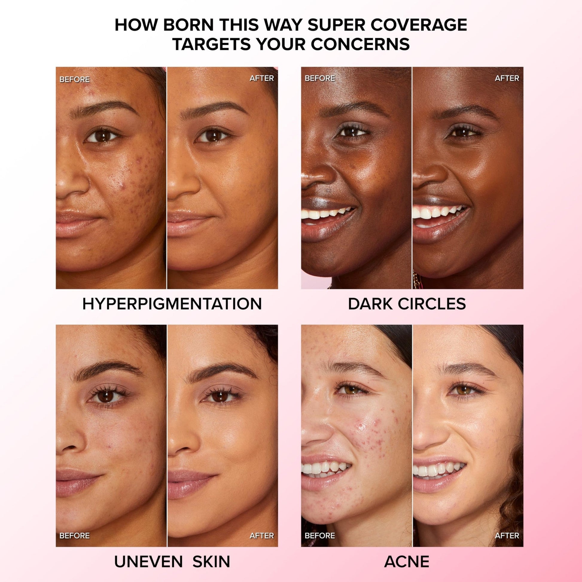 Too Faced Born This Way Super Coverage Multi-Use Concealer | Full Coverage, Non-Comedogenic, Oil Free + Long Lasting Concealer | Hyaluronic Acid + Coconut Water, 0.45 Fl Oz, Light Beige - Medaid International