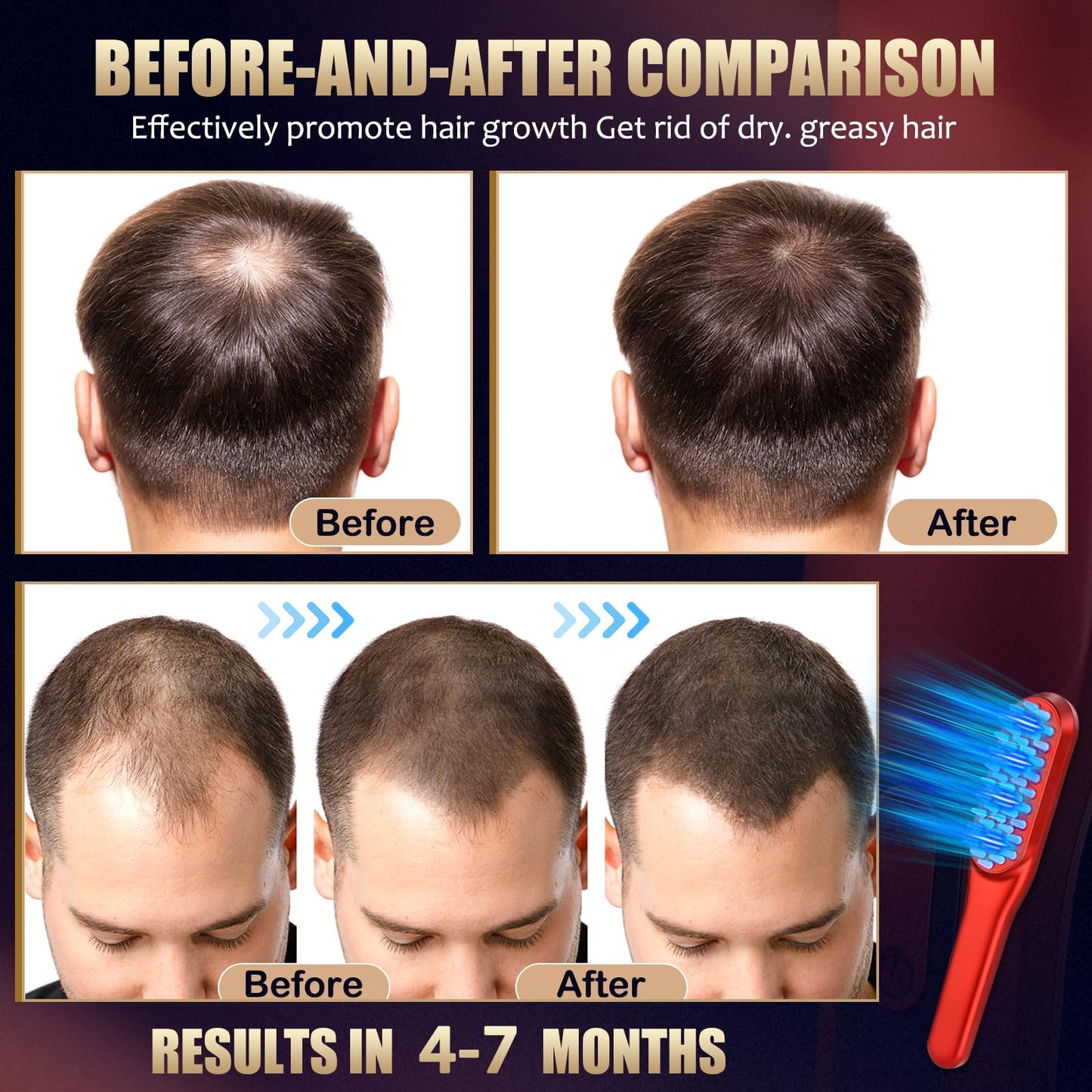 Laser Hair Growth Comb，Red Light Hair Growth Treatment for Men & Women（Red 1pcs ） - Medaid International