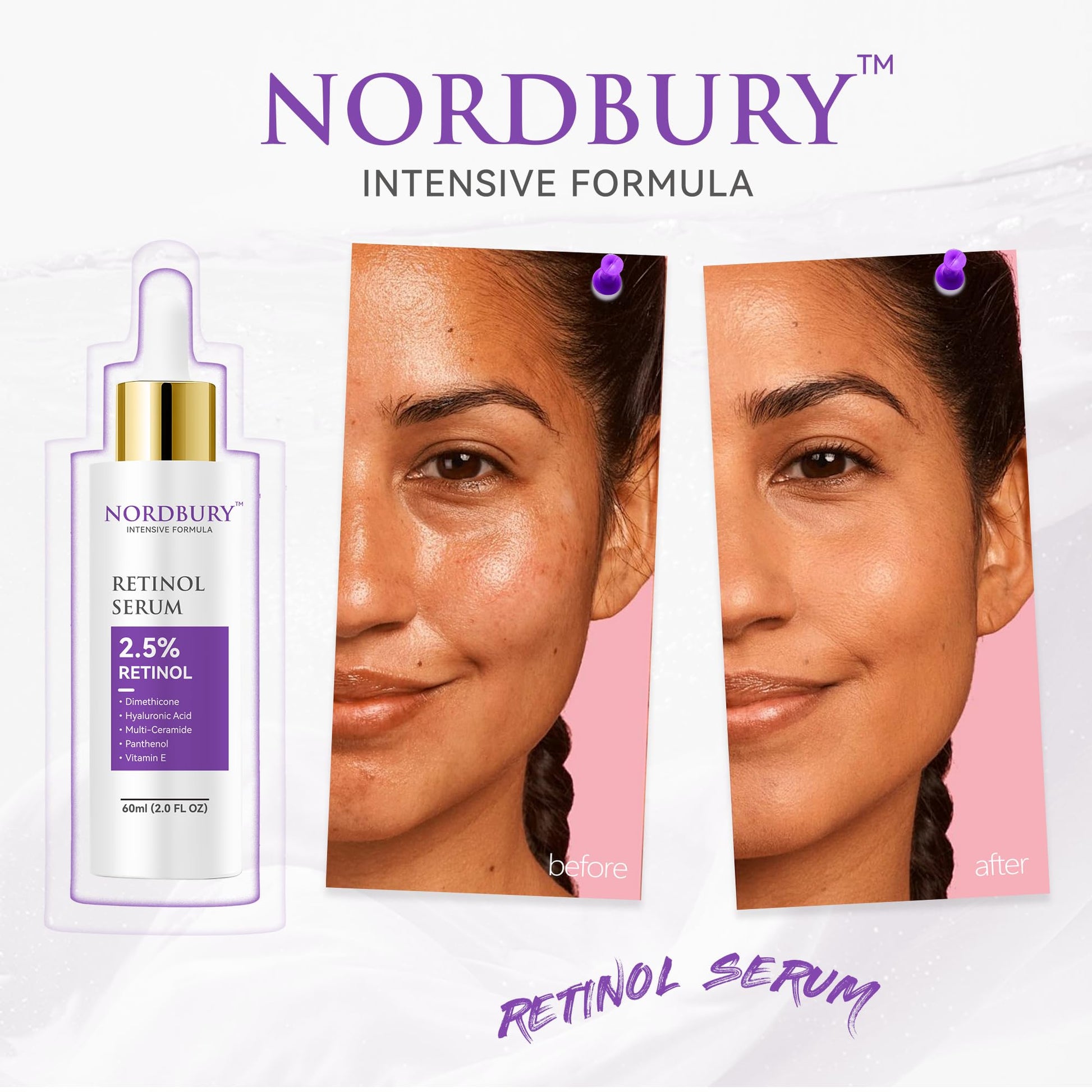 NORDBURY Retinol Serum, 2.5% Retinol with Vitamin E Ceramide Hyaluronic Acid & Organic Aloe Vera, Smooth Fine Lines Reduce Wrinkles and Improve Texture Skin Renewal Actively Night & Day, 60ml - Medaid International