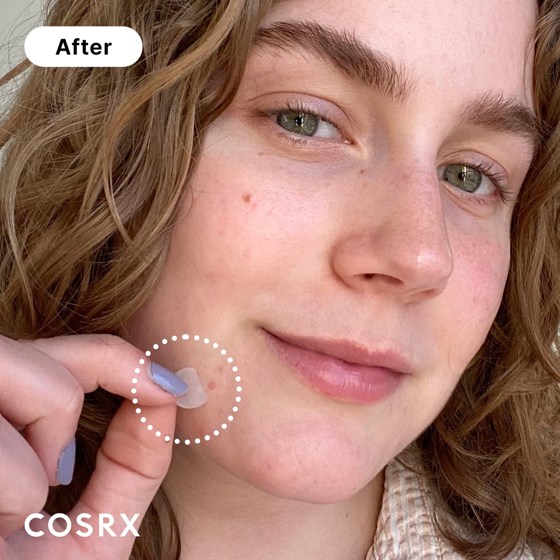 COSRX Acne Pimple Patch (96) Absorbing Hydrocolloid Original 3 Size Patches for Blemishes and Zits Cover, Spot Stickers for Face and Body, Not Tested on Animals - Medaid International
