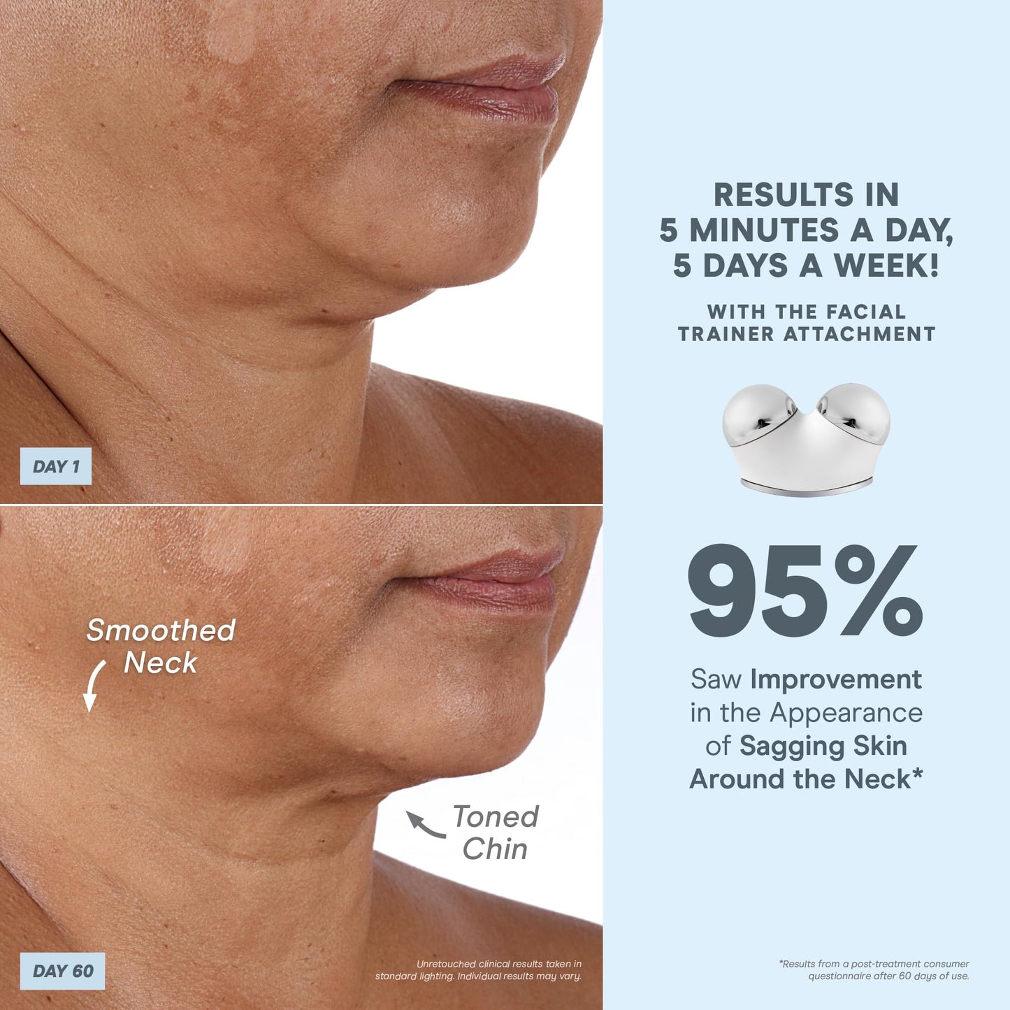 NuFACE Trinity+ Microcurrent Facial Device + Effective Lip & Eye Attachment - FDA Cleared Skin Tightening & Face Toning Device for Targeted Treatment + Microcurrent Gel Activator, Silk Crème & Brush - Medaid International