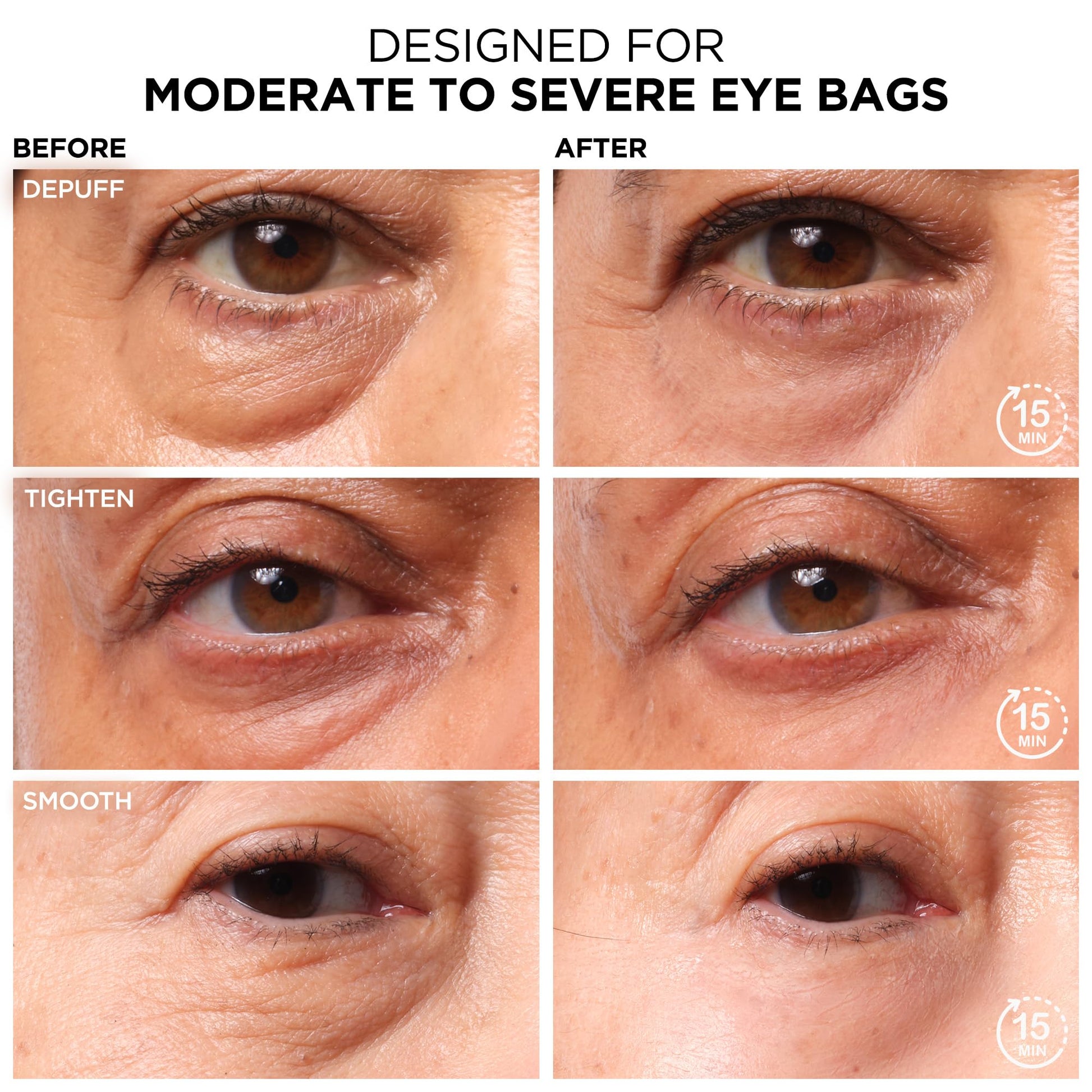IT Cosmetics Bye Bye Under Eye Bags Treatment For Women & Men – Temporary Eye Bag Reducer & Undereye Corrector Depuffs, Tightens, Smooths & Reduces Look of Wrinkles & Fine Lines - 0.5 Fl. Oz - Medaid International