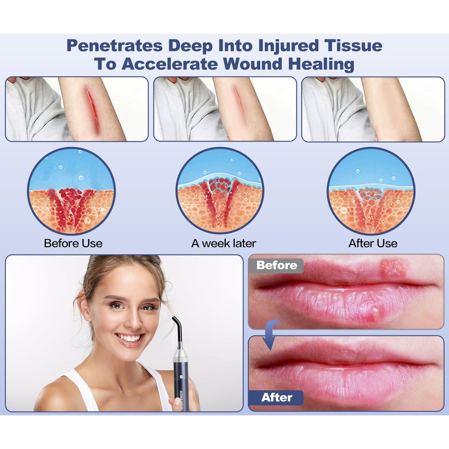 Infrared Red Light Therapy Device for Joints & Muscles Pain Relief, 460:630:660:850:900nm Cold Sore Canker Fever Treat, Portable Near Infrared Wand for Face & Body Mouth Nose Effective 2 in 1 Modes - Medaid International