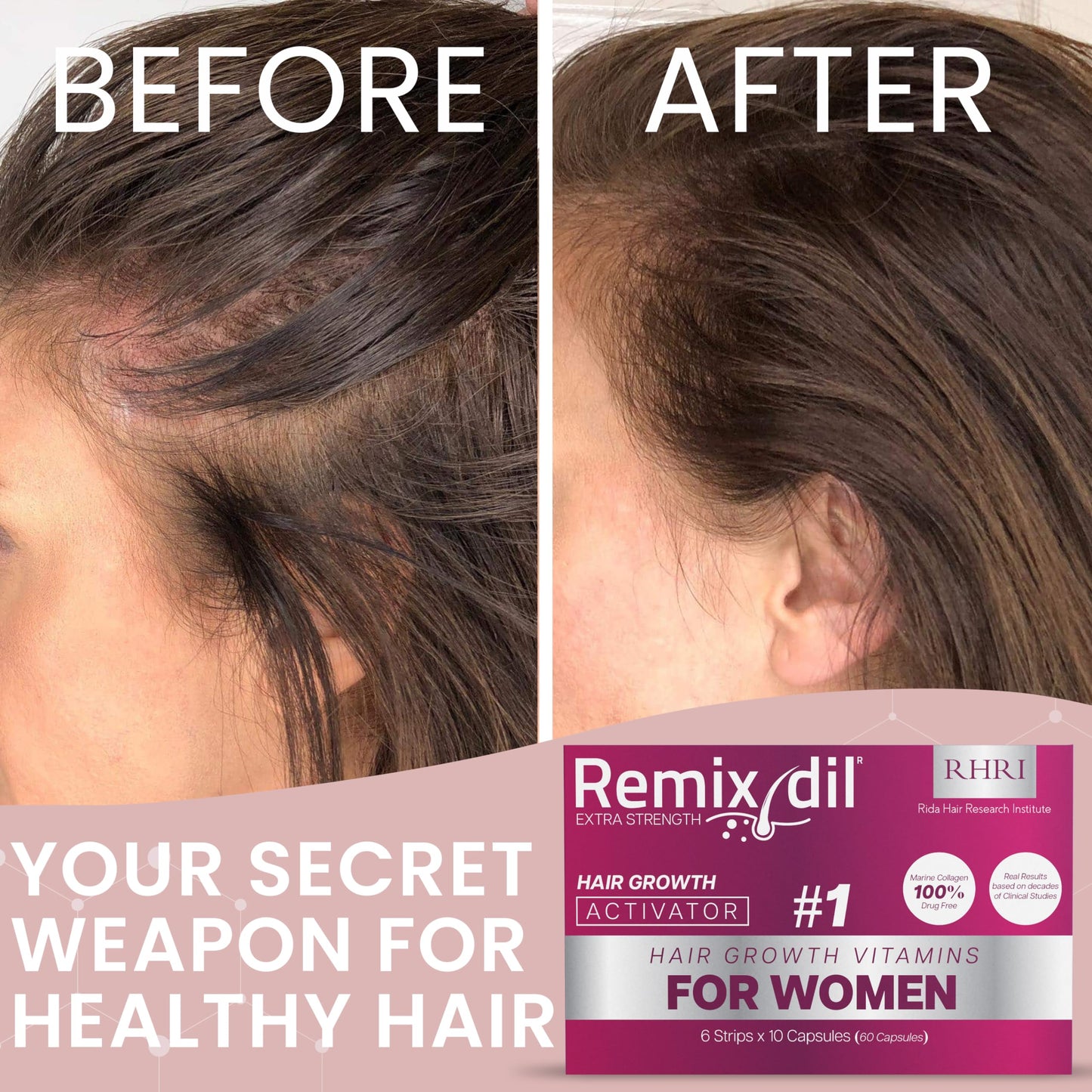 Hair Growth Vitamins for Visibly Thicker & Stronger Hair - Supplements for Hair Loss Treatment and Thinning Hair in Women - Medaid International