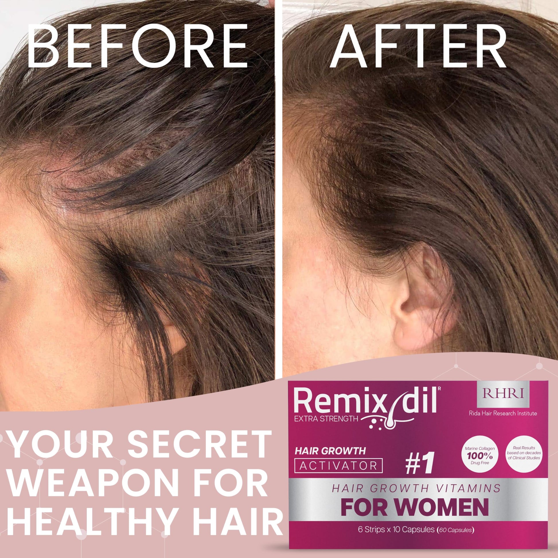 Hair Growth Vitamins for Visibly Thicker & Stronger Hair - Supplements for Hair Loss Treatment and Thinning Hair in Women - Medaid International