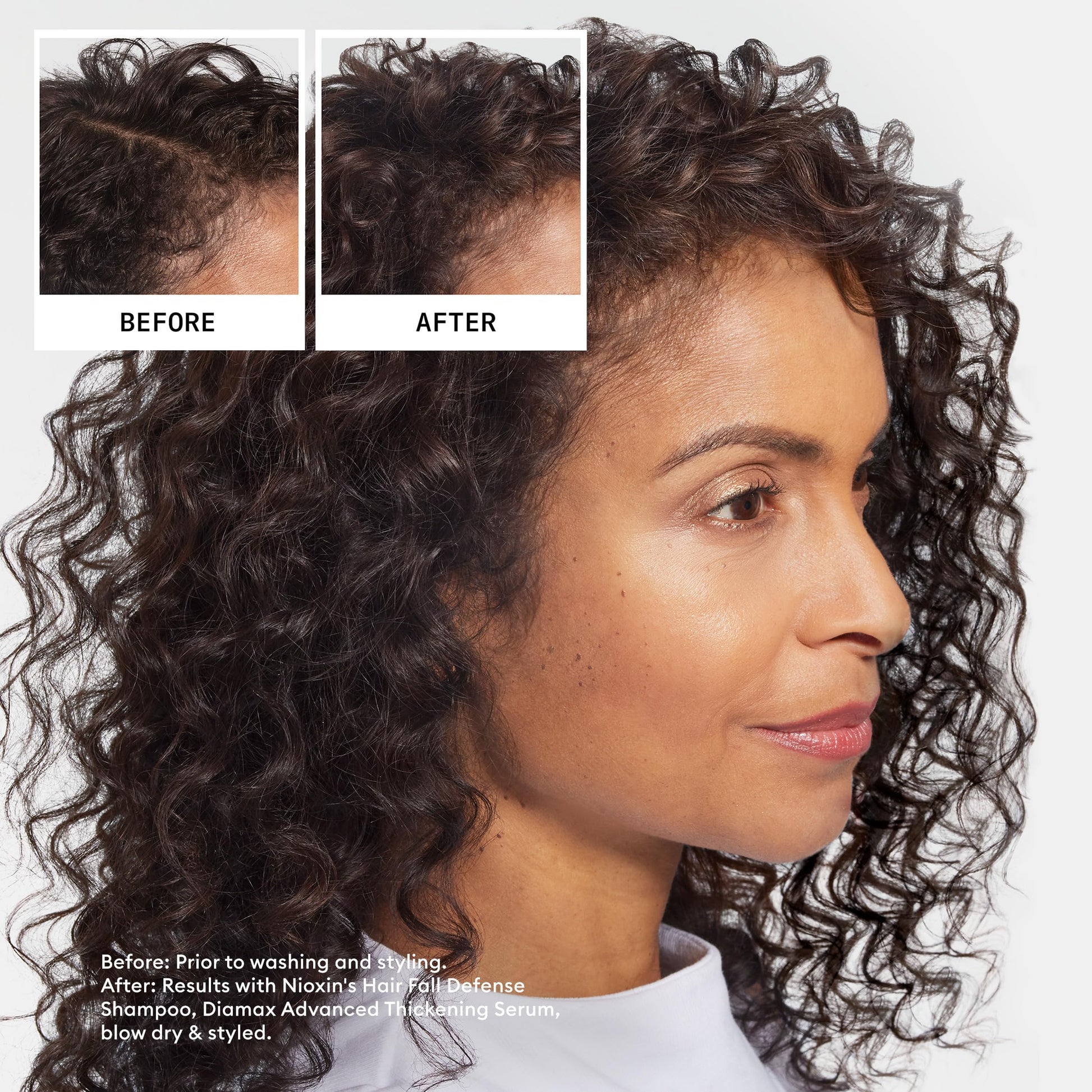 Nioxin Hair Fall Defense Shampoo | Activates Hair Follicles for Visibly Less Hair Loss | With Niacinamide, Caffeine, Lauric Acid, and Sandalore | 8.1 Fl Oz. - Medaid International