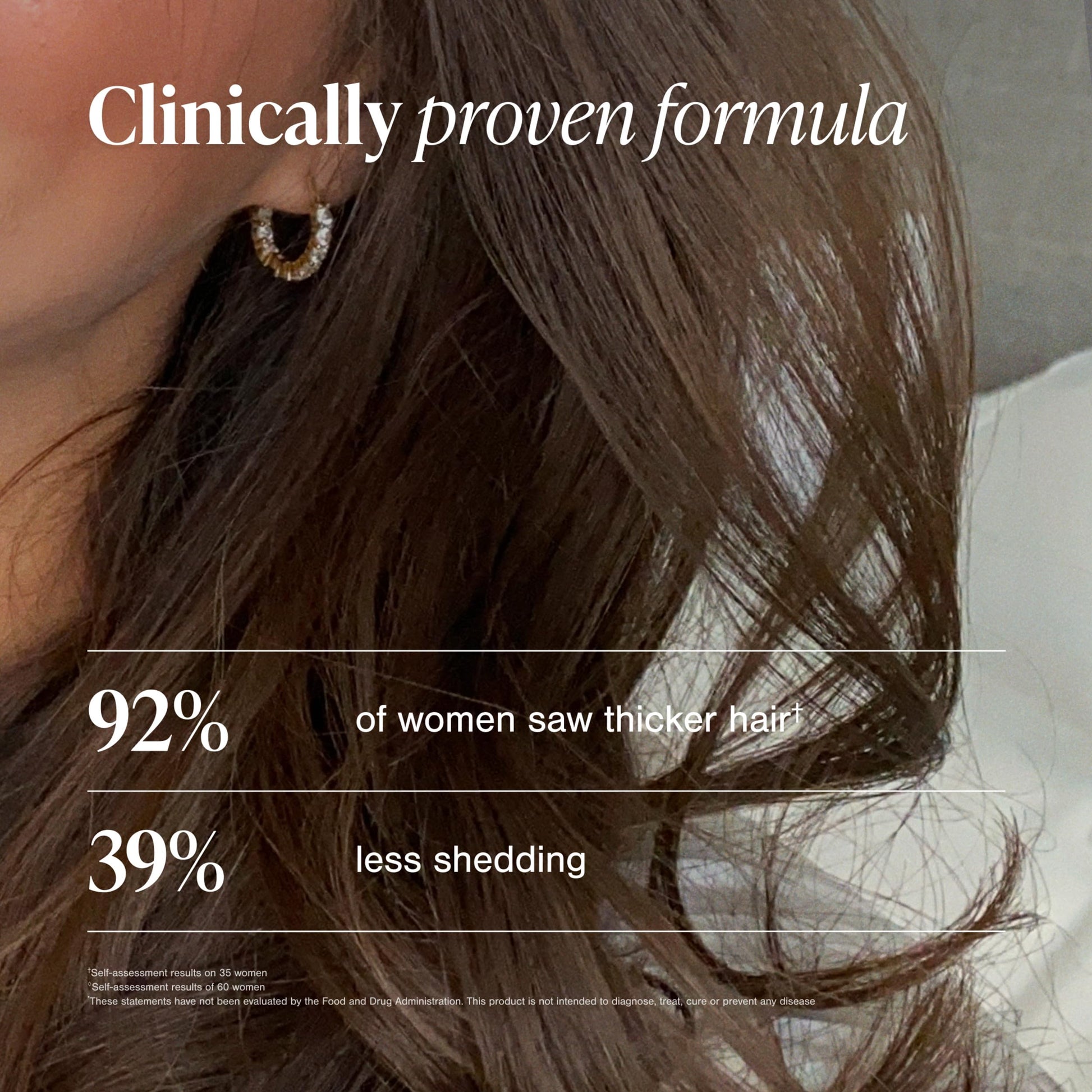 Viviscal Hair Growth Supplements for Women, Thicker Fuller Hair Support for Thinning Hair and Hair Loss, with Biotin and Marine Collagen, Drug-Free, 180 Tablets, 90-Day Supply - Medaid International