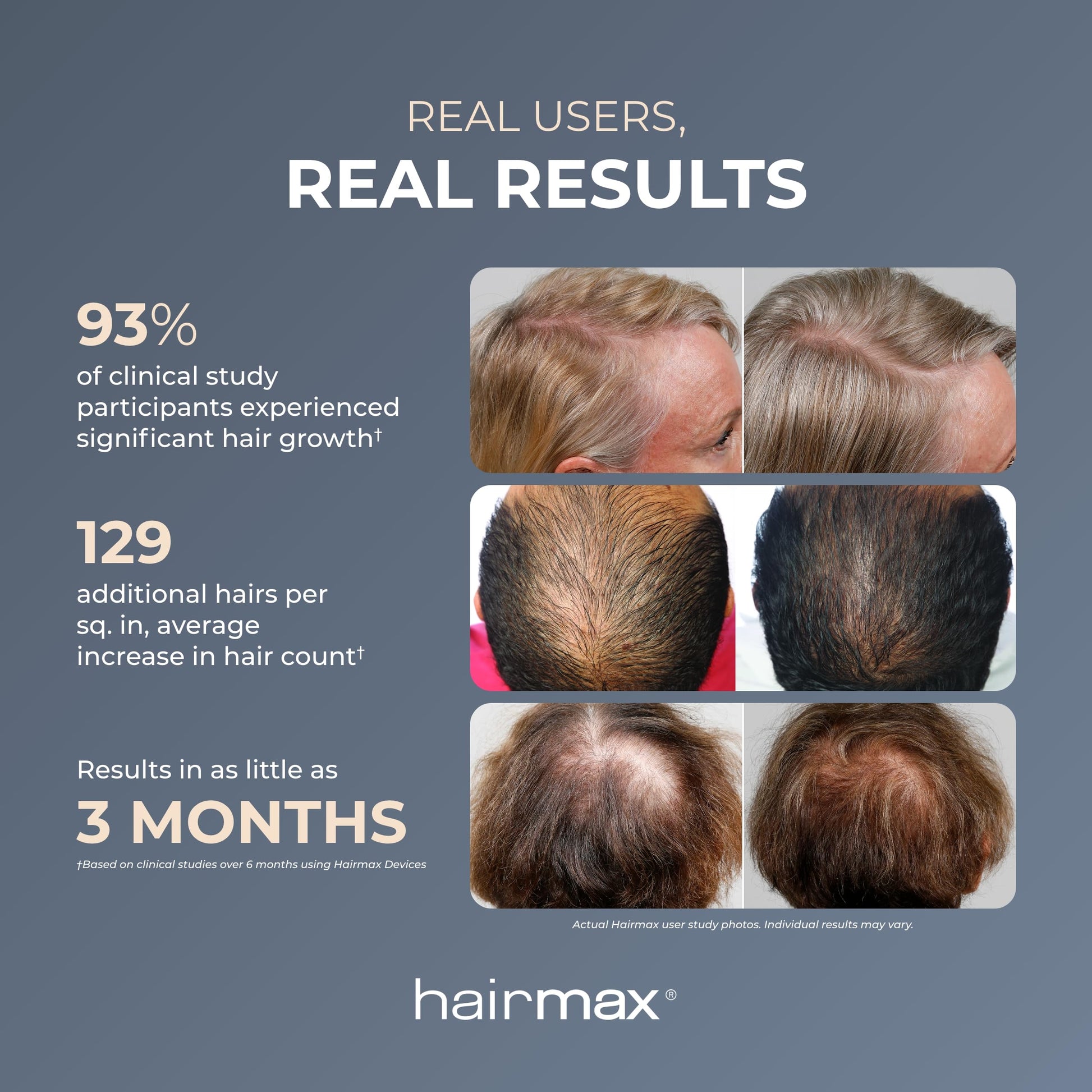 Hairmax Ultima 9 Classic LaserComb -(FDA Cleared) Laser Hair Regrowth Treatment Device for Men & Women - Reverses Thinning Hair Loss - Red Light Therapy to Stimulate Hair Growth - Cordless Design - Medaid International