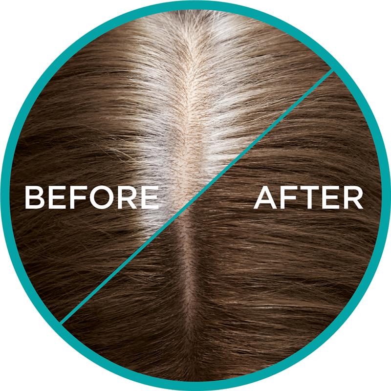 L'Oreal magic retouch hair spray - Medaid International