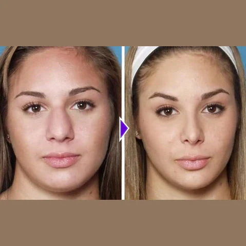 Nose Sculpting Device