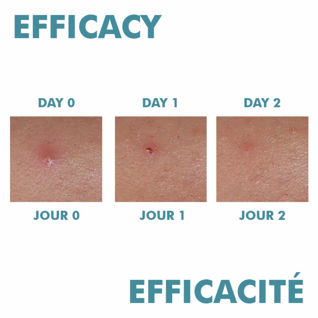 Avène Cleanance Comedomed Peeling Intensive Cream For Breakouts