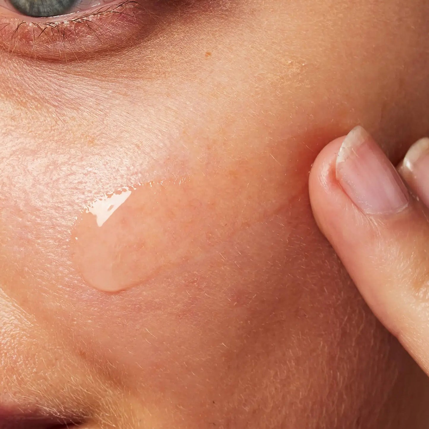 Blemish Control Gel Moisturiser - Medaid - Lebanon
