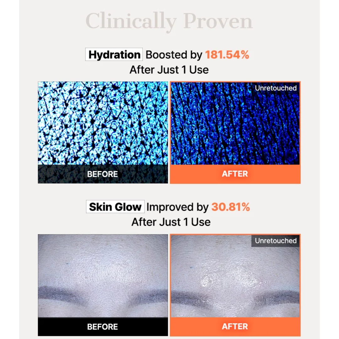 Cosrx 5 PDRN Hyaluronic Acid Vital Hydrating Hydrogel Mask