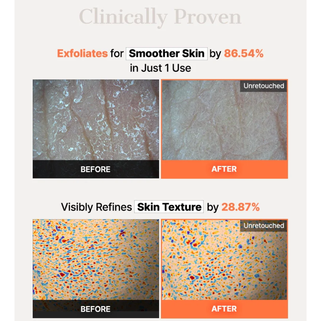 Cosrx 5 PDRN Hyaluronic Acid Vital Hydrating Hydrogel Mask