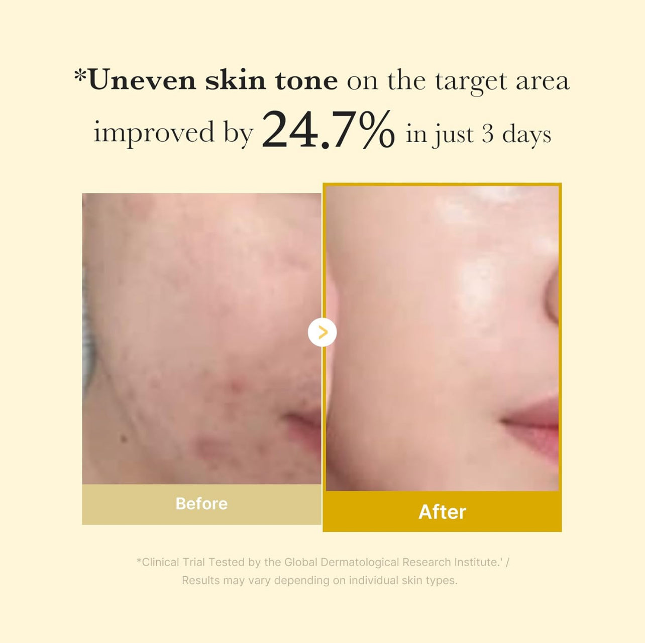 medicube Kojic Acid Turmeric Night Wrapping Peel Off Mask -