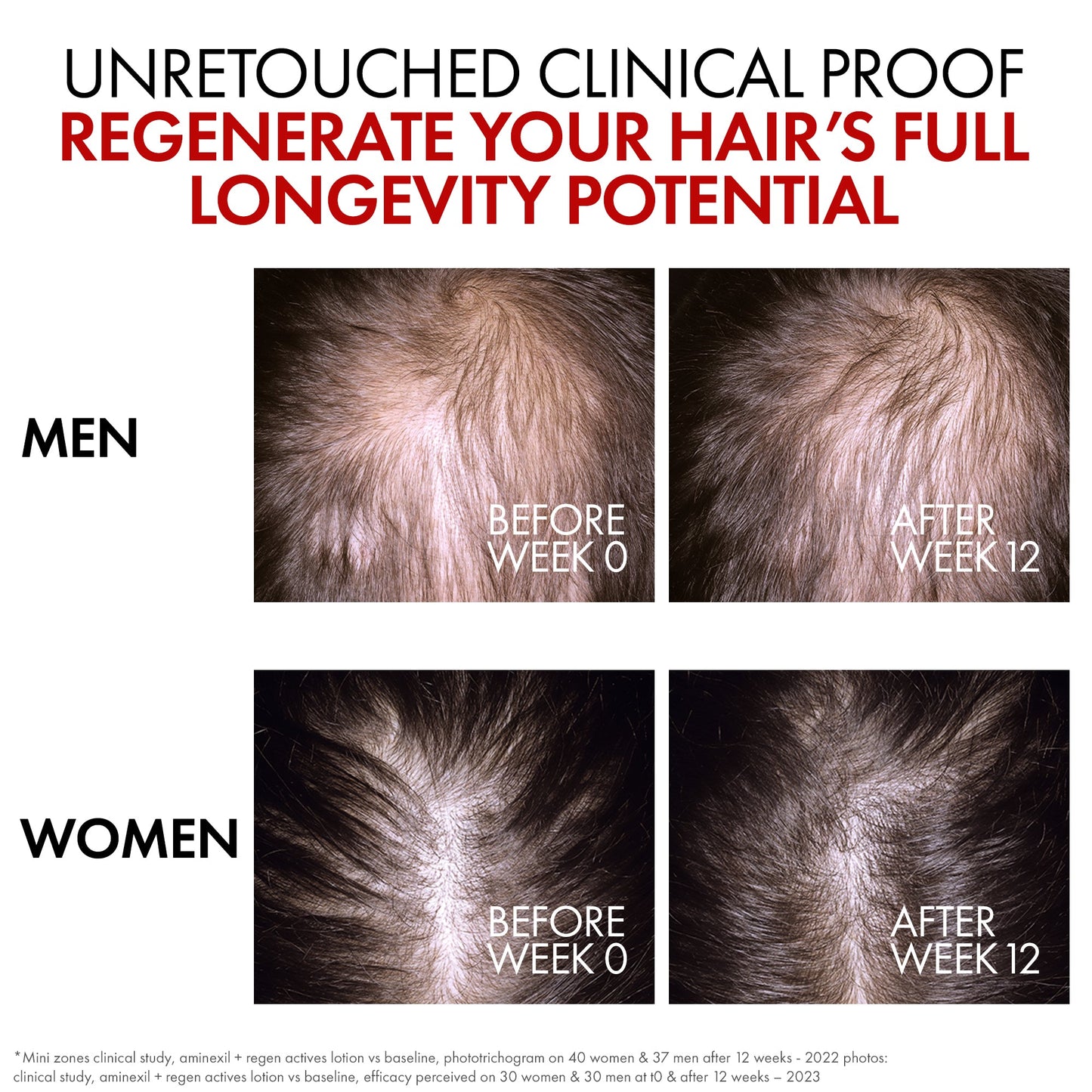 Dercos aminexil clinical R.E.G.E.N. Booster