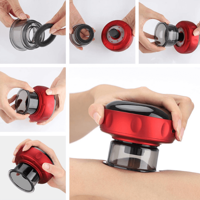 Electric Cupping Therapy | Muscle Relief - Medaid International
