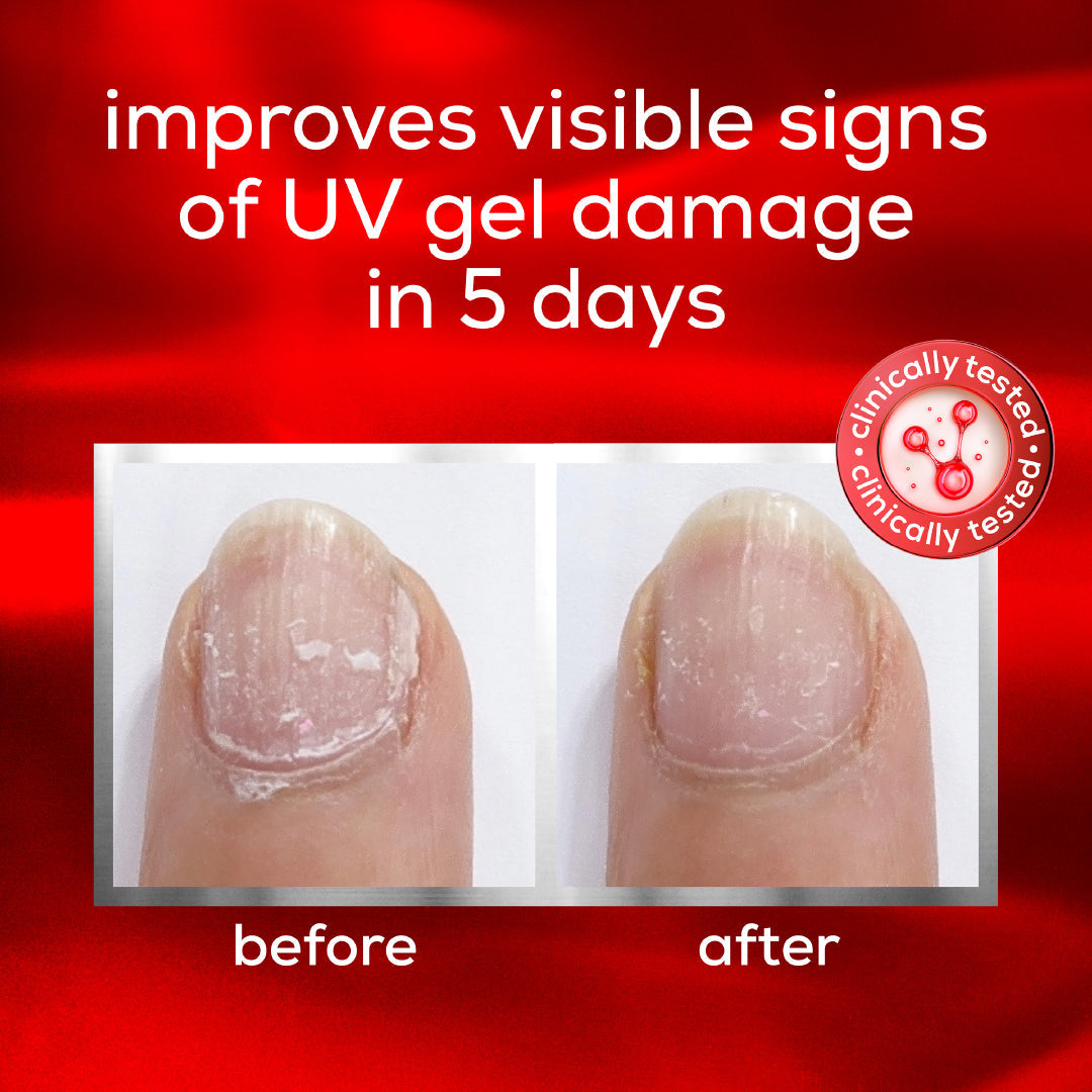 Essie Nail Care To The Rescue Repair Gel 260 Flashed