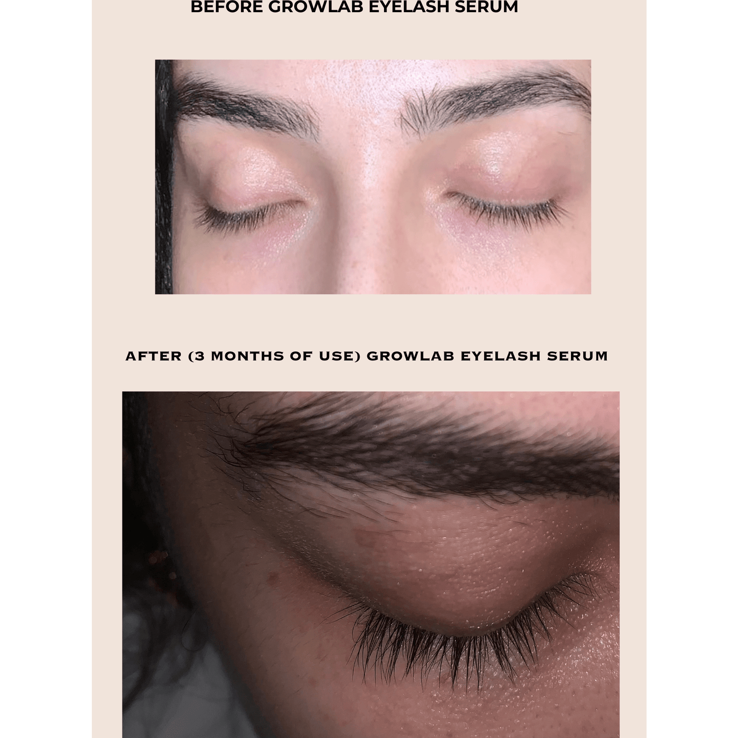 GROWLAB Eyelash Serum - Medaid International