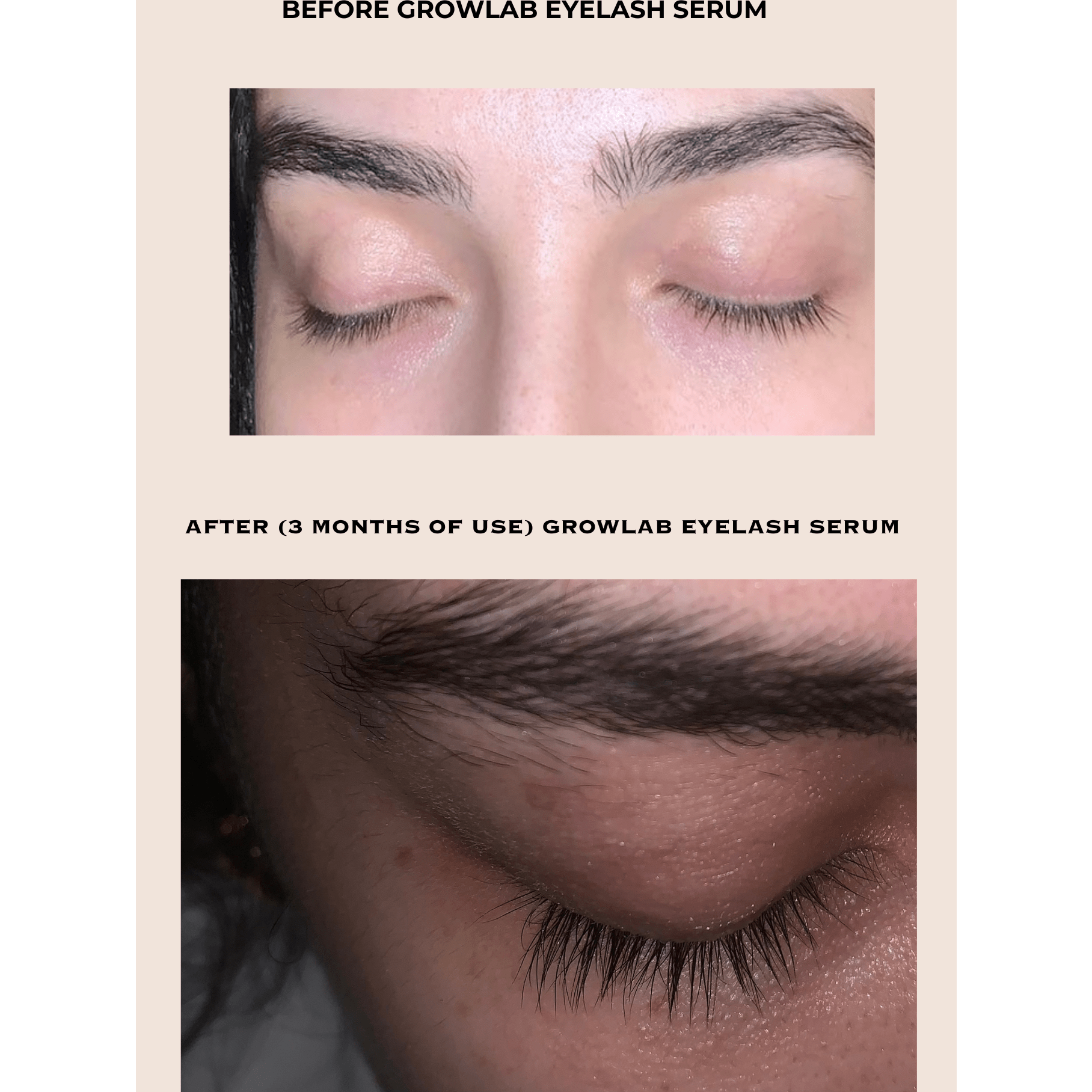 GROWLAB Eyelash Serum - Medaid International