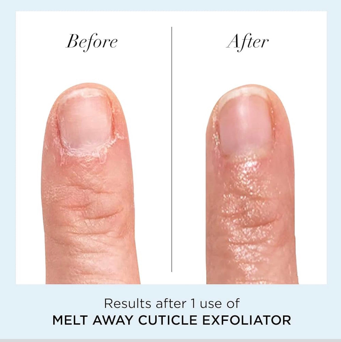 Butter LONDON Cuticle Remover Liquid, Melt Away - Cuticle Softener Oil Exfoliator Gently Removes Dry & Overgrown Skin - Nail Care for Clean & Healthy-Looking Nails, Home Manicure & Pedicure - 0.4 FL