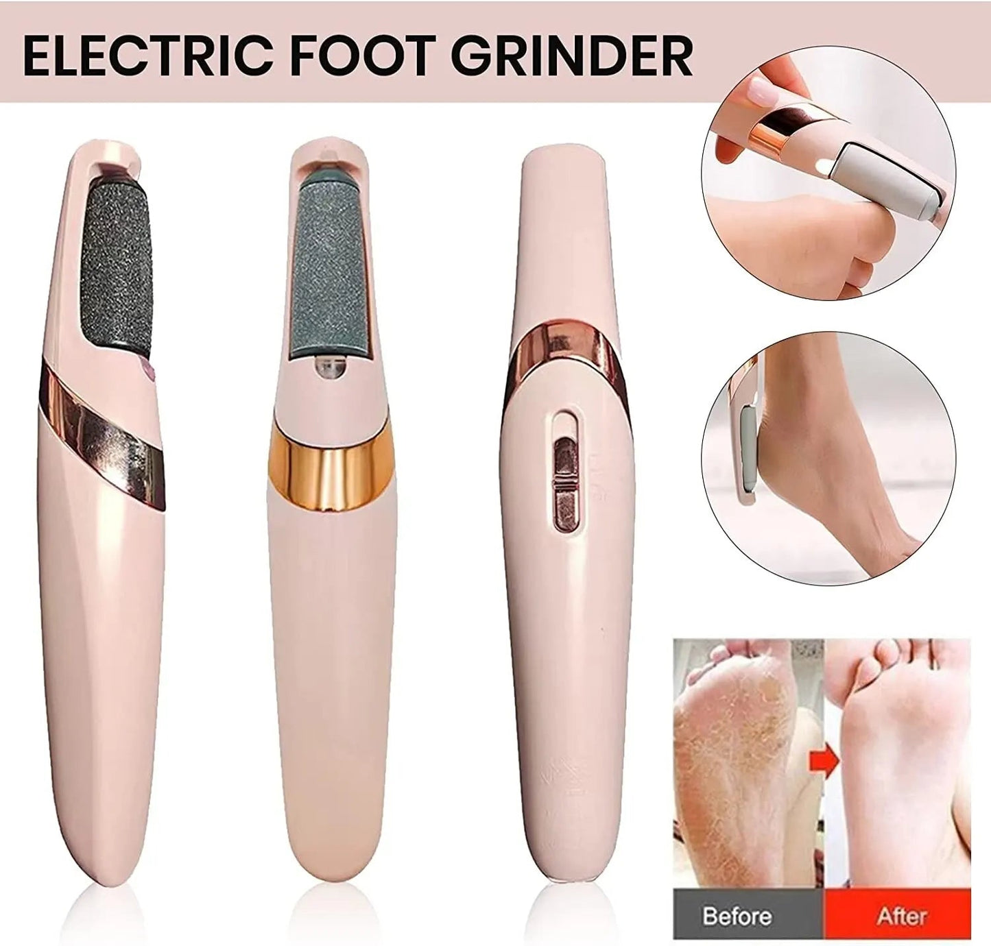 Electric Foot File