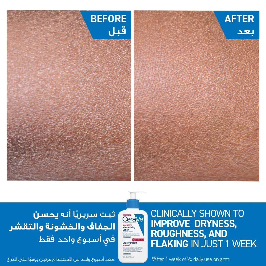 CERAVE INTENSIVE MOISTURISING LOTION FOR VERY DRY SKIN 236ML