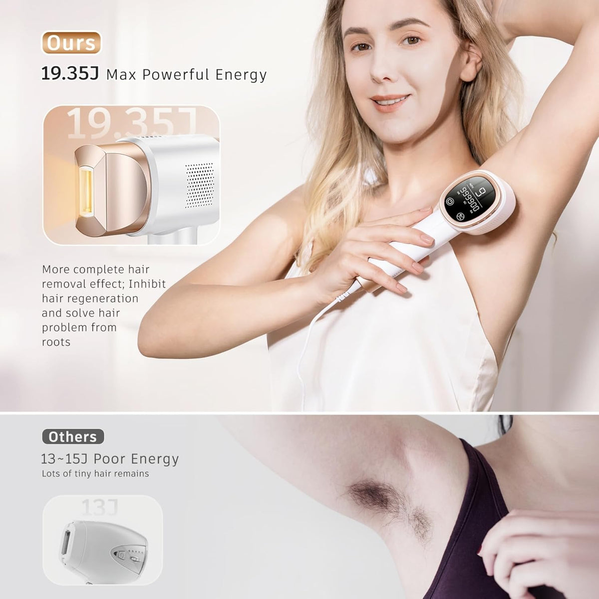 IPL Laser Hair Removal Device