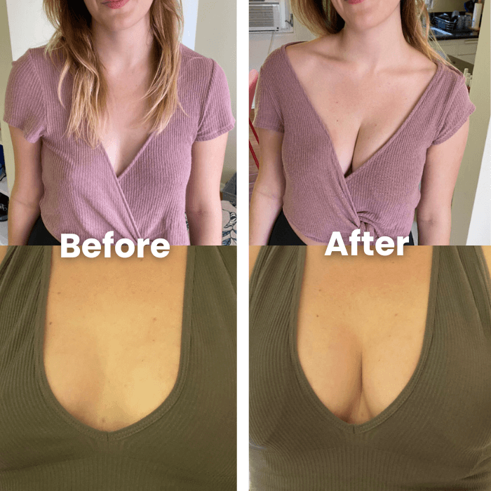 Strapless Push-Up Bra | Invisible & Sweat Proof - Medaid International
