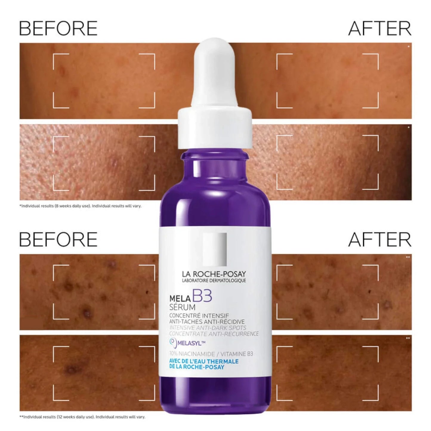 La Roche Posay Mela B3 Serum Intensive Anti-Dark Spots Concentrate 30ml