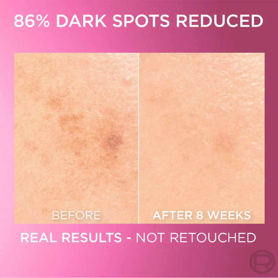 L’Oreal Paris Glycolic Bright Serum with 8% [Melasyl ™ + Glycolic Acid + Niacinamide] face serum for Dark Spots & Brightening 30ml