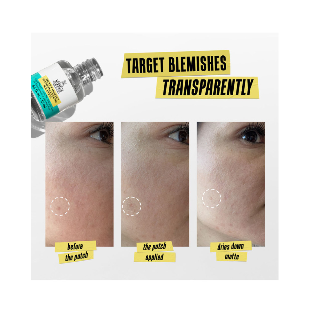 Kiehl's Acne Clearing Solution Spot Blemish Treatment 15ml