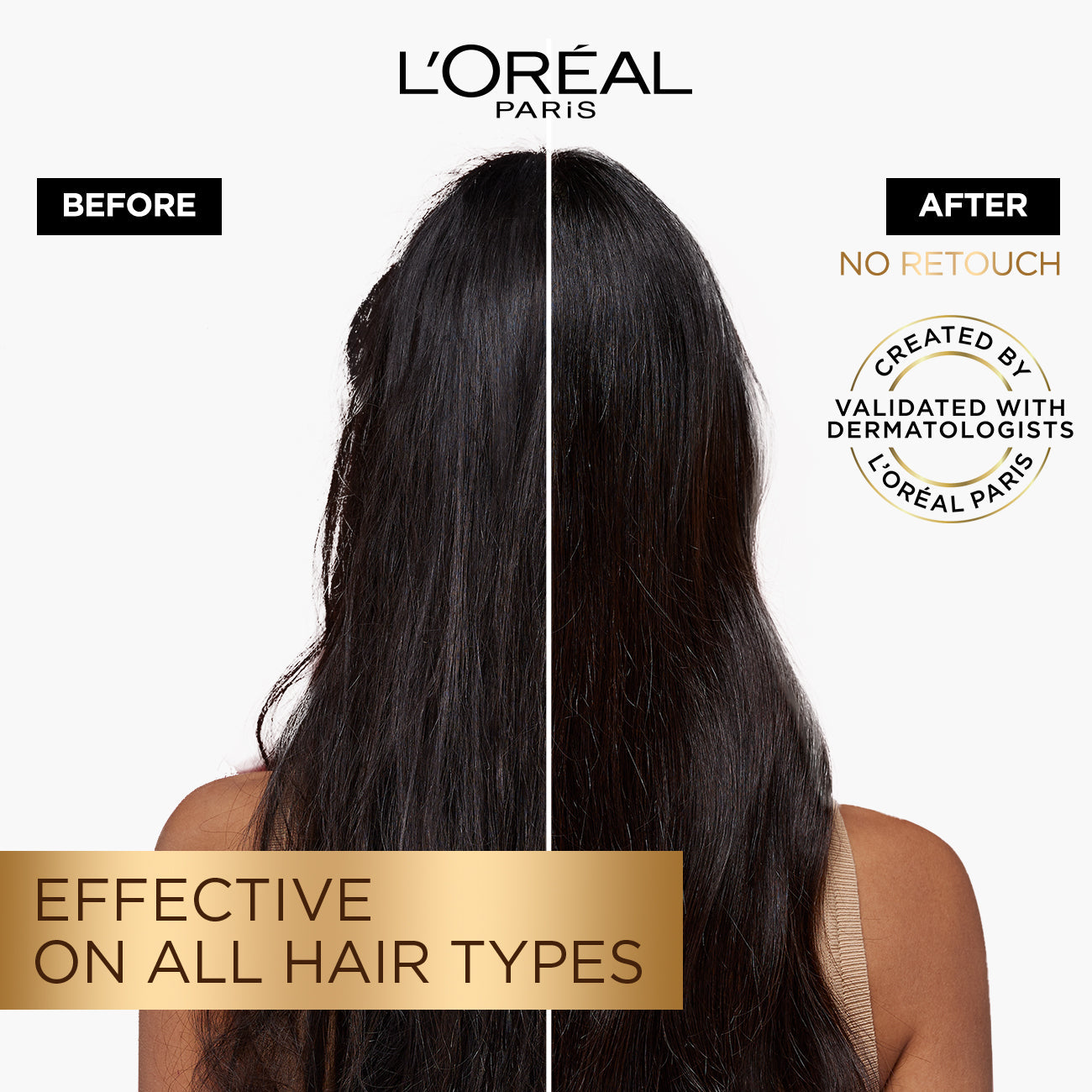 L'Oréal Paris Elvive Fall Resist Anti Hair-Fall Serum With Aminexil 102ml