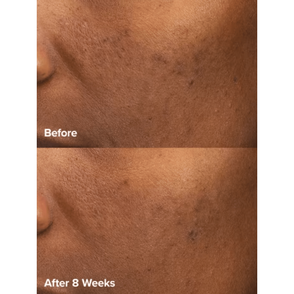 Paula's Choice - Skin Perfecting 6% Mandelic Acid + 2% Lactic Acid Liquid Exfoliant - Medaid International