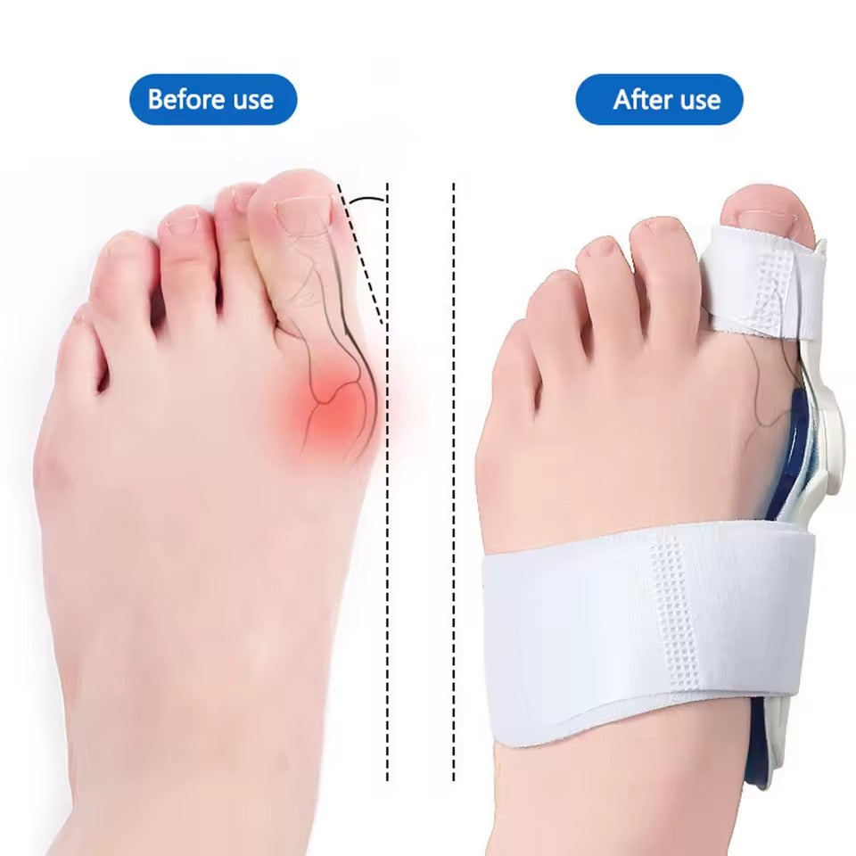 Big Toe Corrector Strap